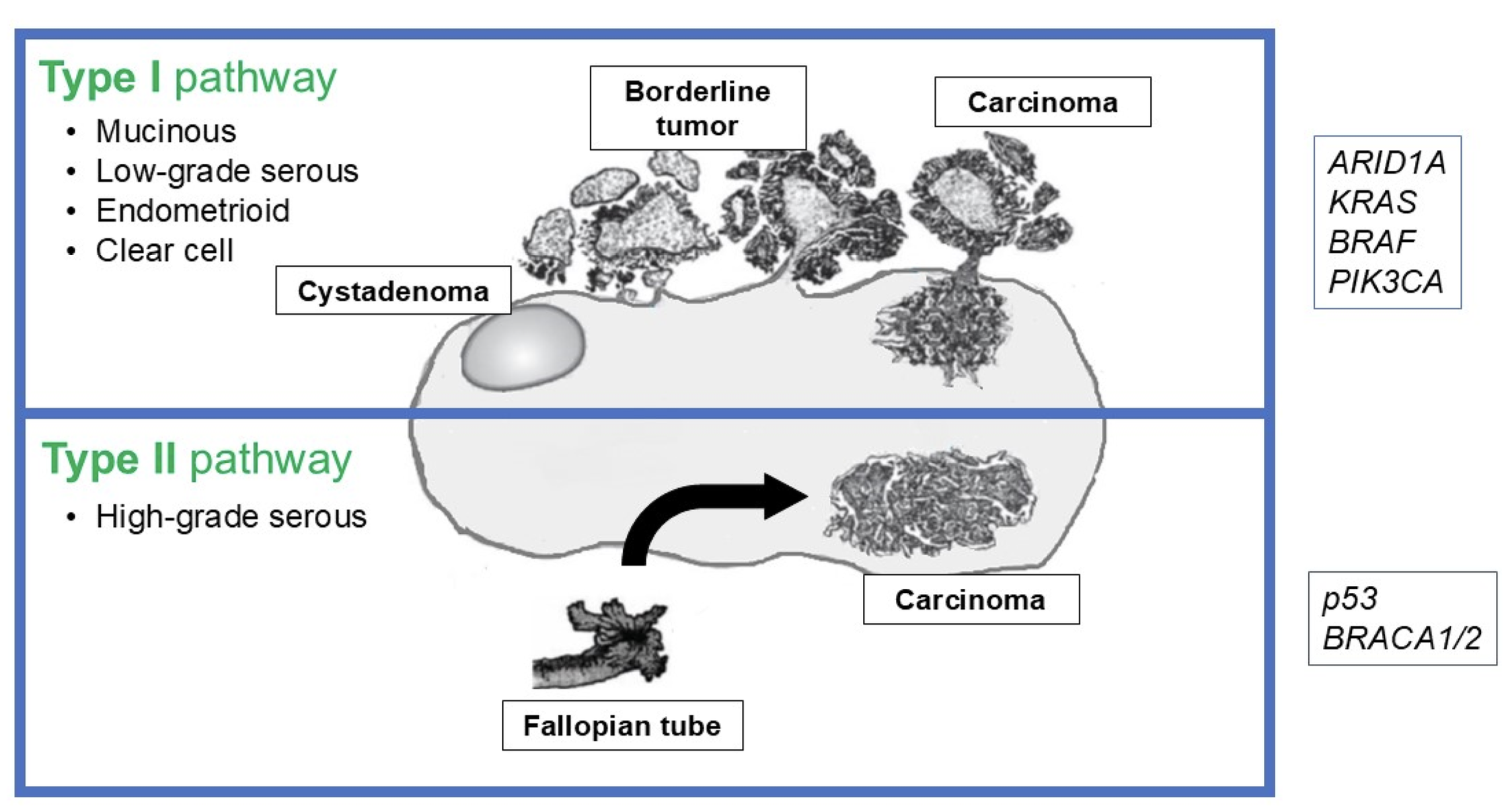Recent clinical and molecular findings in low-grade serous ovarian ...